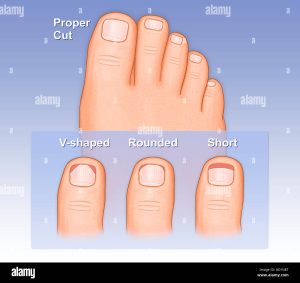 Toenails should be cut – The Outdoor Women